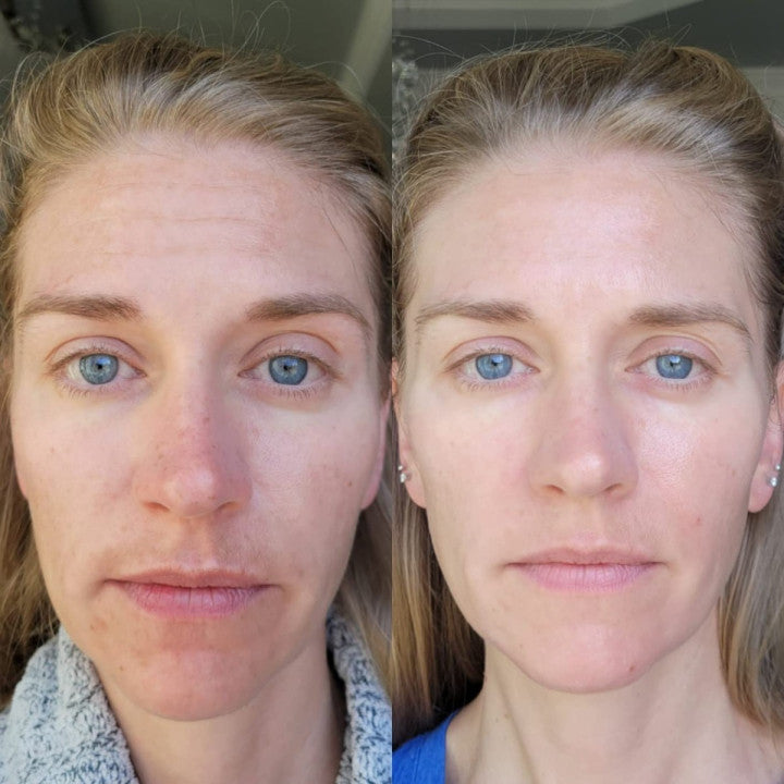 Glow Sense Pro Oferr